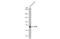 Acetylcholinesterase antibody, GTX636298, GeneTex, Western Blot image 