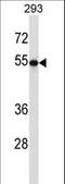 Tubulin Beta 2A Class IIa antibody, LS-C160330, Lifespan Biosciences, Western Blot image 