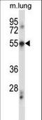 Programmed Cell Death 7 antibody, LS-C163462, Lifespan Biosciences, Western Blot image 