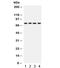 Protein Kinase C Eta antibody, R32029, NSJ Bioreagents, Western Blot image 