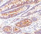 Carcinoembryonic Antigen Related Cell Adhesion Molecule 5 antibody, AM33325PU-S, Origene, Immunohistochemistry frozen image 