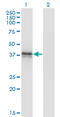 Beta-1,3-Glucuronyltransferase 3 antibody, LS-C139355, Lifespan Biosciences, Western Blot image 