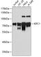 Kinesin Family Member C1 antibody, 19-028, ProSci, Western Blot image 