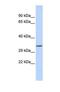 Testis Expressed 264, ER-Phagy Receptor antibody, NBP1-69517, Novus Biologicals, Western Blot image 