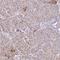 Hydroxyacyl-CoA Dehydrogenase Trifunctional Multienzyme Complex Subunit Beta antibody, HPA037540, Atlas Antibodies, Immunohistochemistry paraffin image 