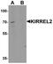 Kirre Like Nephrin Family Adhesion Molecule 2 antibody, PA5-72823, Invitrogen Antibodies, Western Blot image 