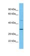Family With Sequence Similarity 110 Member D antibody, orb327000, Biorbyt, Western Blot image 