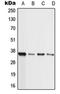 Lysine Methyltransferase 2B antibody, orb214927, Biorbyt, Western Blot image 