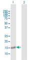 Pleckstrin Homology Domain Containing J1 antibody, H00055111-B01P, Novus Biologicals, Western Blot image 