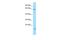 Sosondowah Ankyrin Repeat Domain Family Member C antibody, A16250, Boster Biological Technology, Western Blot image 