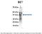 Protein SET antibody, ARP56542_P050, Aviva Systems Biology, Immunoprecipitation image 