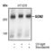 Eukaryotic Translation Initiation Factor 2 Alpha Kinase 4 antibody, PA5-17523, Invitrogen Antibodies, Western Blot image 