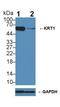 Keratin 1 antibody, LS-C294985, Lifespan Biosciences, Western Blot image 