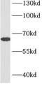 Protein Tyrosine Phosphatase Non-Receptor Type 6 antibody, FNab07853, FineTest, Western Blot image 