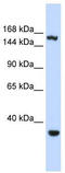 Eukaryotic Translation Initiation Factor 4 Gamma 3 antibody, TA345855, Origene, Western Blot image 