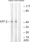 Activating Transcription Factor 2 antibody, LS-C118051, Lifespan Biosciences, Western Blot image 