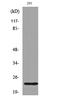 BCL2 Associated Agonist Of Cell Death antibody, A03520S112-1, Boster Biological Technology, Western Blot image 