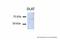 Dihydrolipoamide S-Acetyltransferase antibody, 29-681, ProSci, Western Blot image 