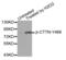 Cortactin antibody, LS-C335902, Lifespan Biosciences, Western Blot image 