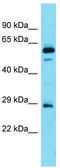 Family With Sequence Similarity 110 Member D antibody, TA337333, Origene, Western Blot image 