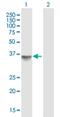 Ribosomal Protein Lateral Stalk Subunit P0 antibody, H00006175-B01P, Novus Biologicals, Western Blot image 