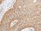 Serine/Threonine Kinase 32B antibody, GTX107555, GeneTex, Immunohistochemistry paraffin image 