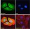 O-Linked N-Acetylglucosamine (GlcNAc) Transferase antibody, NB100-57845, Novus Biologicals, Immunofluorescence image 