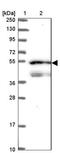 Signal Recognition Particle 54 antibody, NBP2-13380, Novus Biologicals, Western Blot image 