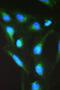 Serine Palmitoyltransferase Long Chain Base Subunit 1 antibody, PB9894, Boster Biological Technology, Immunofluorescence image 