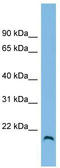 Hemojuvelin BMP Co-Receptor antibody, TA337622, Origene, Western Blot image 