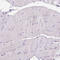 CD3 antibody, AMAb90879, Atlas Antibodies, Immunohistochemistry frozen image 