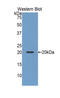 Slit Guidance Ligand 2 antibody, LS-C305619, Lifespan Biosciences, Western Blot image 