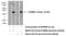 Potassium Calcium-Activated Channel Subfamily M Regulatory Beta Subunit 2 antibody, 16606-1-AP, Proteintech Group, Western Blot image 