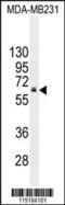 HNF1 Homeobox B antibody, 55-640, ProSci, Western Blot image 