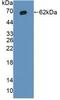 Inhibitor Of Nuclear Factor Kappa B Kinase Subunit Beta antibody, abx131198, Abbexa, Western Blot image 
