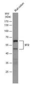 Interleukin 1 Receptor Like 1 antibody, NBP2-53096, Novus Biologicals, Western Blot image 