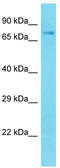 Kelch Like Family Member 26 antibody, TA337230, Origene, Western Blot image 