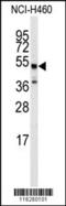 Adrenoceptor Beta 2 antibody, 62-774, ProSci, Western Blot image 