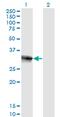 Homeobox protein Hox-B9 antibody, MA5-19117, Invitrogen Antibodies, Western Blot image 