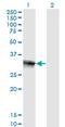 Homeobox B9 antibody, MA5-19117, Invitrogen Antibodies, Western Blot image 