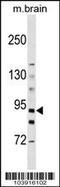 Hexokinase 3 antibody, 63-420, ProSci, Western Blot image 
