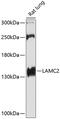 Laminin Subunit Gamma 2 antibody, 18-357, ProSci, Western Blot image 
