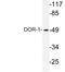 Opioid Receptor Delta 1 antibody, LS-C176653, Lifespan Biosciences, Western Blot image 