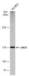 Nitric Oxide Synthase 3 antibody, GTX133404, GeneTex, Western Blot image 