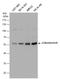 Protein Phosphatase 3 Catalytic Subunit Alpha antibody, GTX111039, GeneTex, Western Blot image 