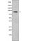 Fibroblast Growth Factor Receptor 2 antibody, abx215352, Abbexa, Western Blot image 