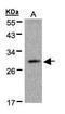 Kallikrein Related Peptidase 2 antibody, GTX100526, GeneTex, Western Blot image 