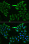 Solute Carrier Family 5 Member 6 antibody, abx004927, Abbexa, Western Blot image 