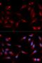 ADAM Metallopeptidase Domain 9 antibody, orb167302, Biorbyt, Immunocytochemistry image 