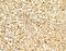 Sterol Regulatory Element Binding Transcription Factor 2 antibody, 7855, ProSci, Immunohistochemistry frozen image 